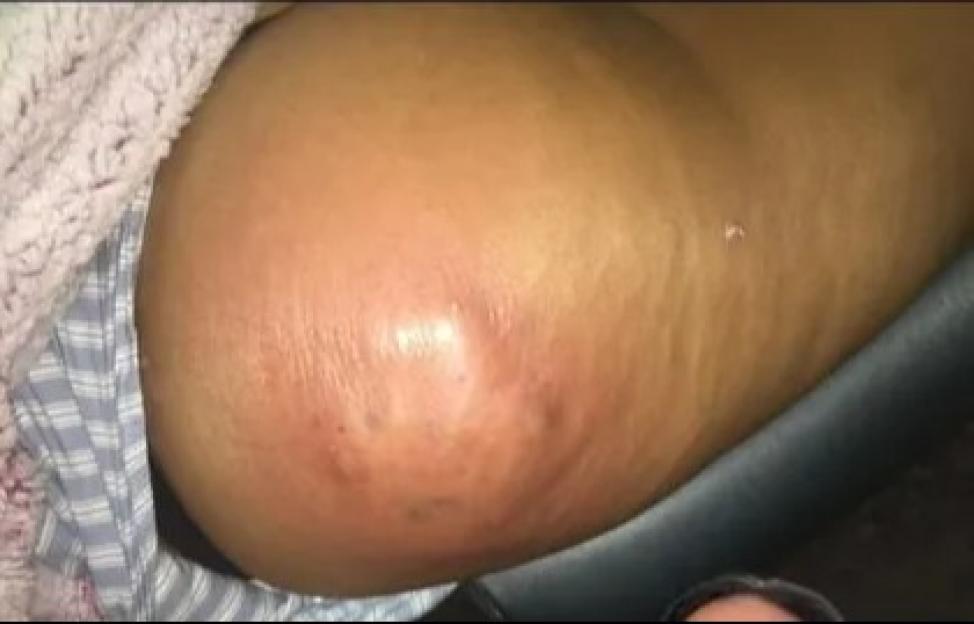 NINTCHDBPICT000882314861