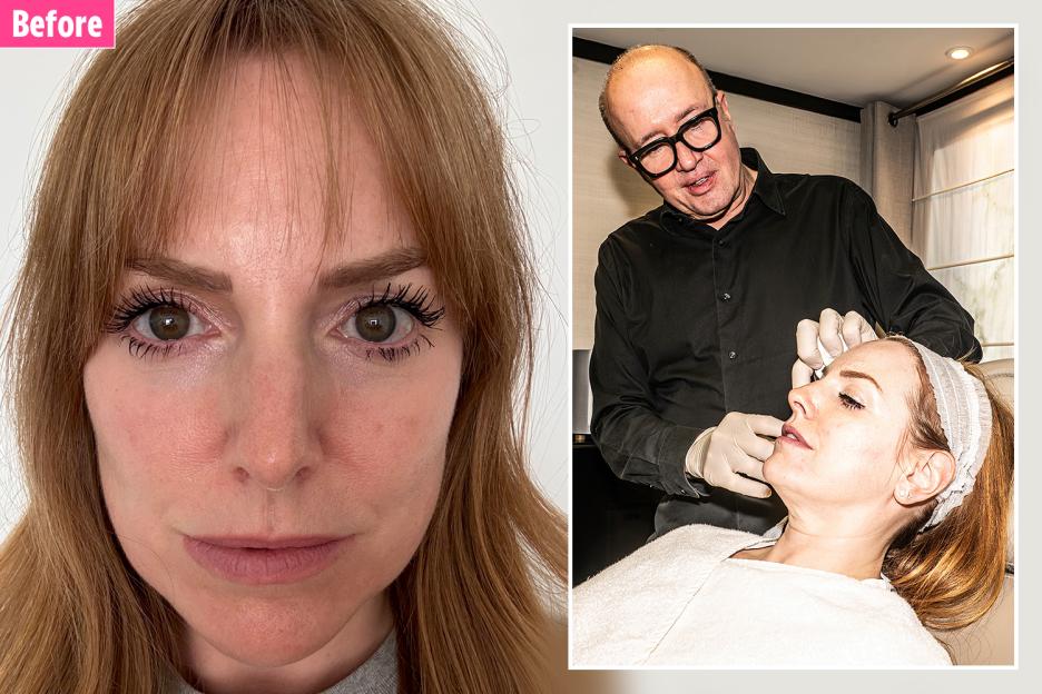 'Cat Deeley's £17-a-Week 'Real Life Filter' Treatment Erased My Wrinkles in Just 4 Weeks—No More Looking Knackered!'