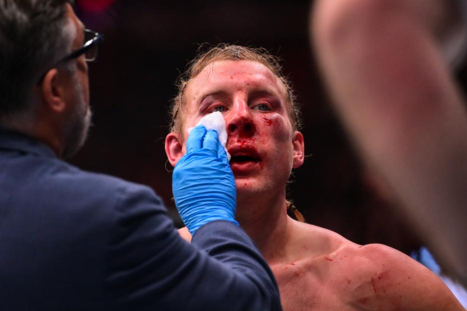 Paddy Pimblett with a bloody face and a blue-gloved hand dabbing his nose with a white cloth during UFC 324.