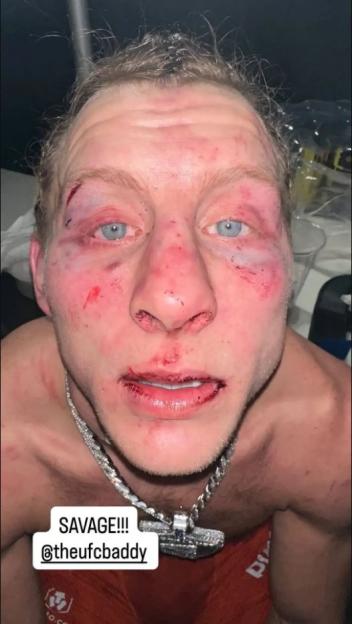 Justin Gaethje Shares the Harsh Five Words He Told Paddy Pimblett After UFC 324 Loss