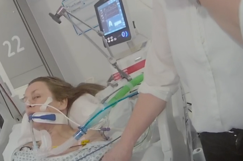 A patient with an endotracheal tube in a hospital bed with a medical monitor displaying vitals.