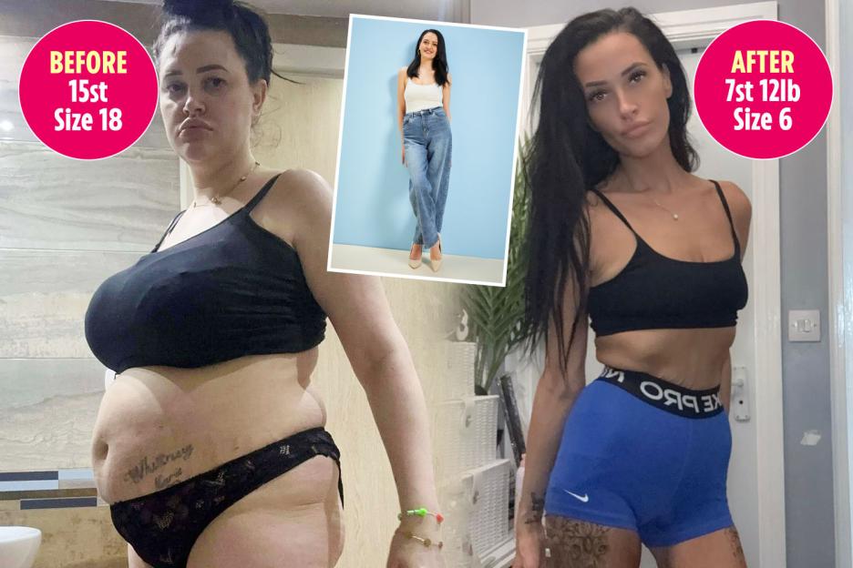 'I Shed Over 7 Stone After Gastric Band Surgery, but Now I'm Stuck Snacking on Cheestrings—Here's My Regretful Journey!'