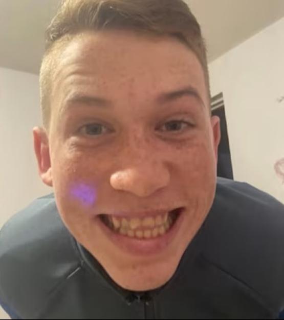 Collage of Roman Casselden, 16, and his sister Darcie, nine.