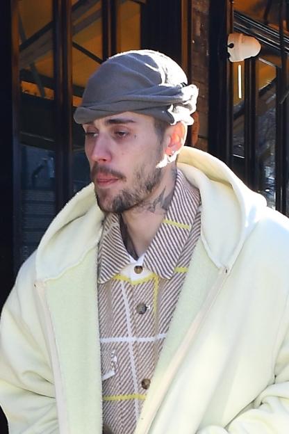 *EXCLUSIVE* Justin Bieber looks worn down as he arrives for lunch at Bar Pitti!