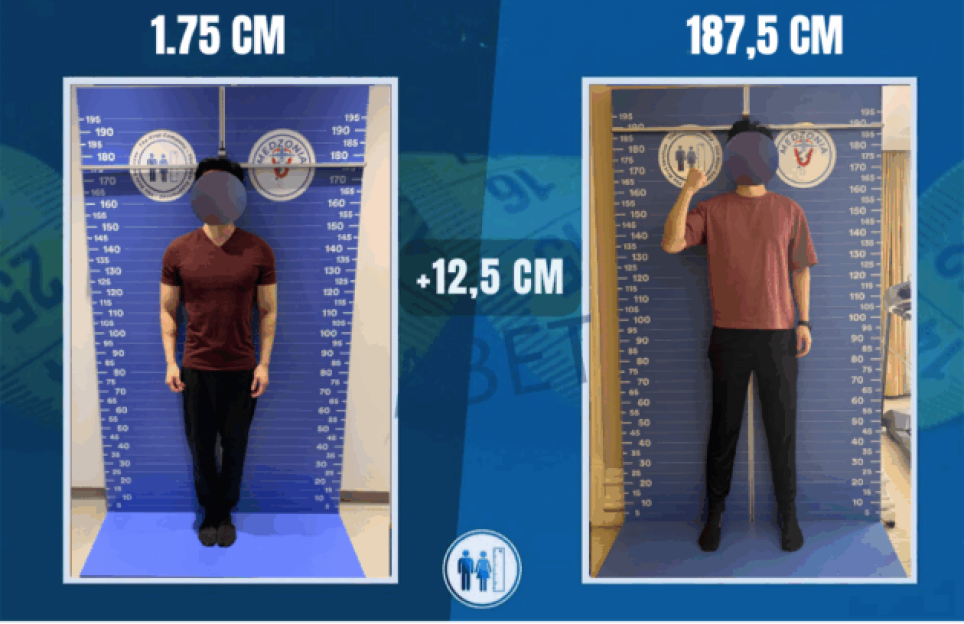 A person with bandages on their legs uses a walker while being assisted by medical staff, with a urine bag visible.