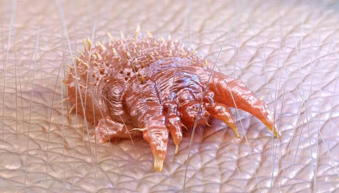 Illustration of a scabies mite