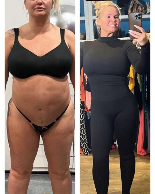 Collage of Kerry Katona before and after weight loss.