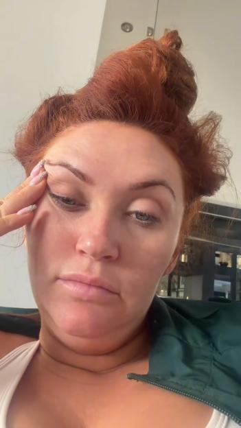 Charlotte Dawson touching her eyelid.