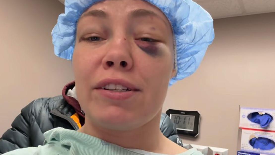 Rose Namajunas to Undergo Eye Surgery After Revealing Shocking Injury from UFC 324