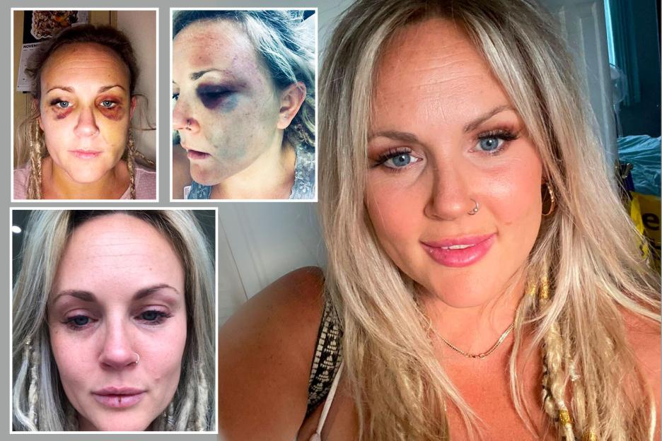 'Escaping Abuse: My Ex's Shocking Hour-Long Attack After I Found the Courage to Leave'