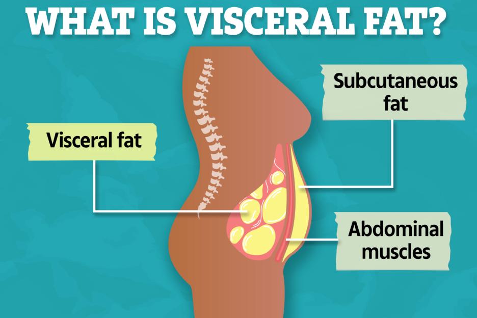 Illustration of visceral fat around internal organs compared to subcutaneous fat.