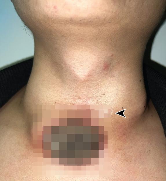 NINTCHDBPICT001069495083