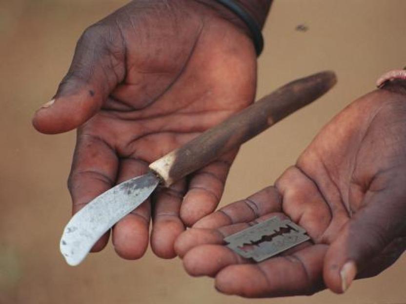 Horrific looking blades used in circumcision often illegally which can lead to gangrene and sepsis and death often used by untrained "surgeons".