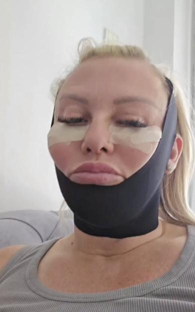 Im like Frankensteins bride after having FULL BODY makeover  even my eyelids and vagina have been transformed
