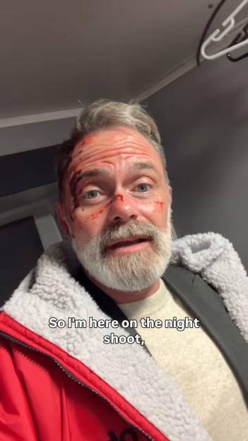 'Coronation Street's Daniel Brocklebank Reveals Shocking Unseen Photos of His Bloodied Face After Intense Crossover Episode'
