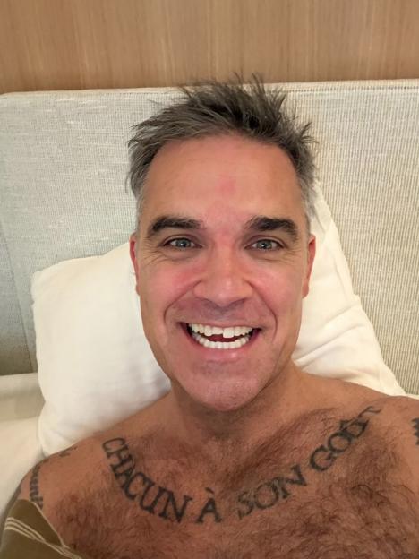 Robbie Williams smiling and showing a chipped front tooth.
