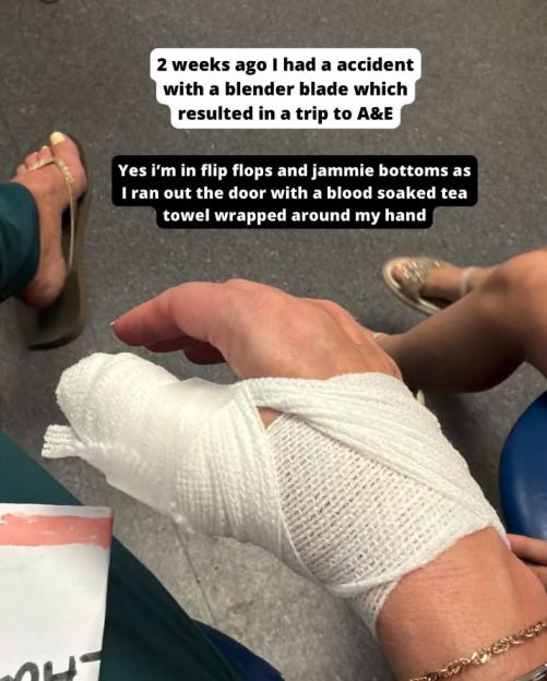A person's bandaged left hand with text describing how they injured it with a blender blade and went to the hospital.