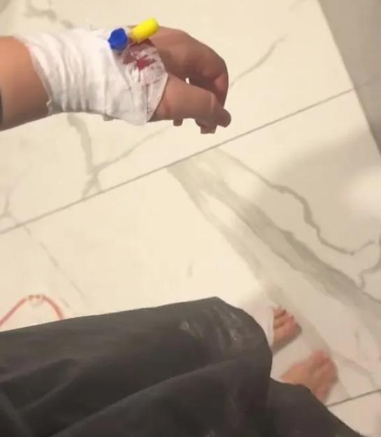 A person's bandaged and bloody hand with an IV, with their bare feet visible below black clothing.