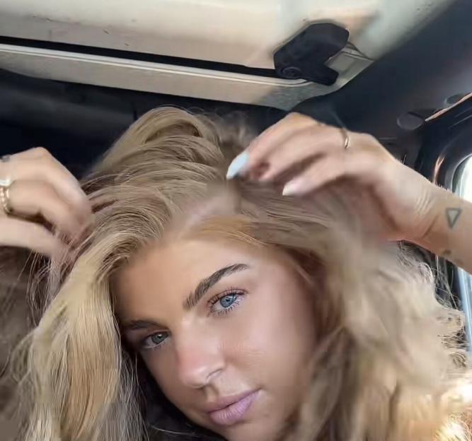 A woman with long blonde hair and blue eyes uses both hands to show her scalp.