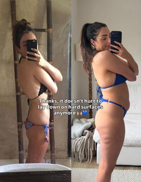 Collage of before and after mirror selfies of a woman showing weight gain.