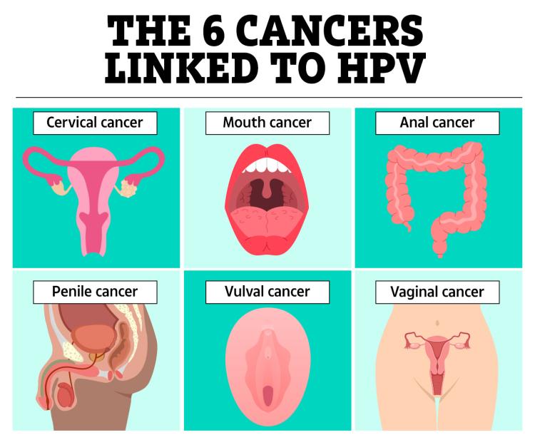 Illustration of six cancers linked to HPV: cervical, mouth, anal, penile, vulval, and vaginal.