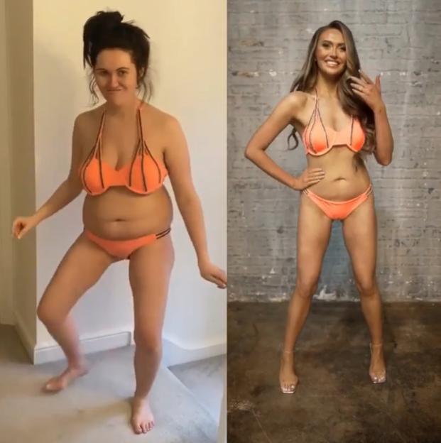 Collage of Charlotte Dawson's before and after photos in an orange bikini.