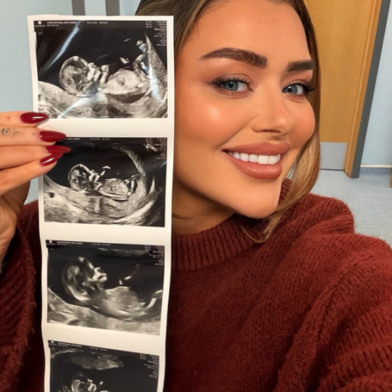 Woman holding up a strip of baby ultrasound images.