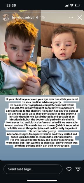 Collage of two photos of a young boy with a swollen left eye, with a white text overlay warning about peri orbital cellulitis.