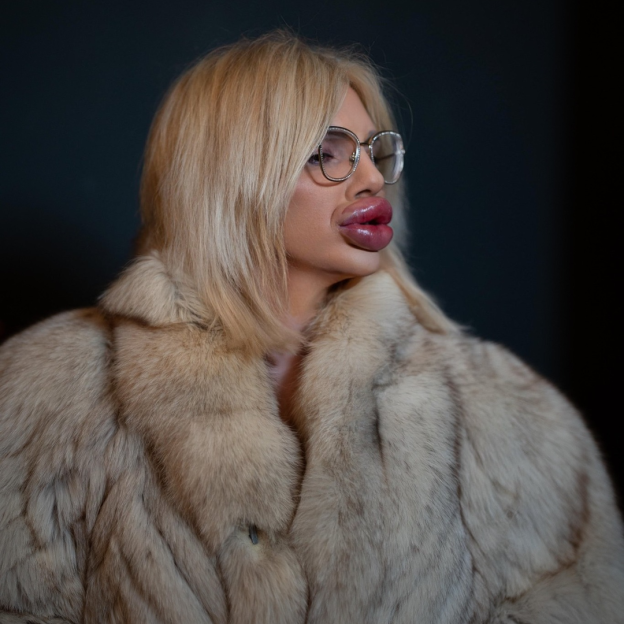 Woman with extremely large lips and blonde hair wearing glasses and a fur coat.