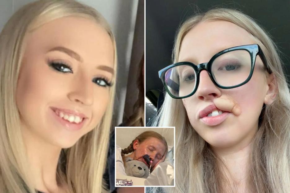 "Dog Attack Left My Face Severely Injured – My Mother’s Heartbreak and My Urgent Wish to Heal"