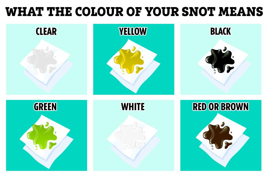 Illustration explaining what the color of your snot means, showing clear, yellow, black, green, white, and red or brown snot on tissues.