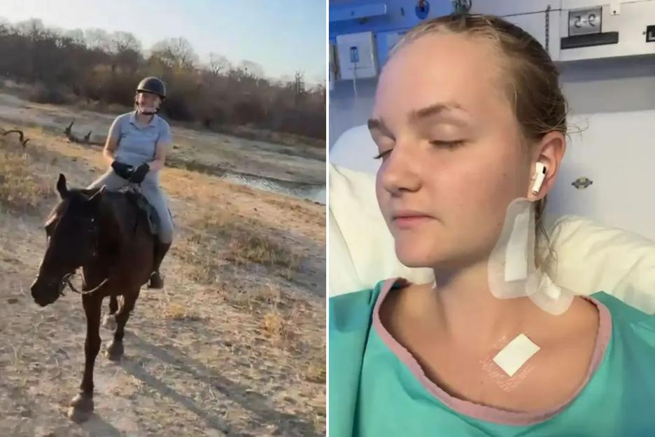 Terrifying Safari Encounter: Lion Grabs Tourist by Neck, Leaving Her with a Broken Back in Near-Death Experience