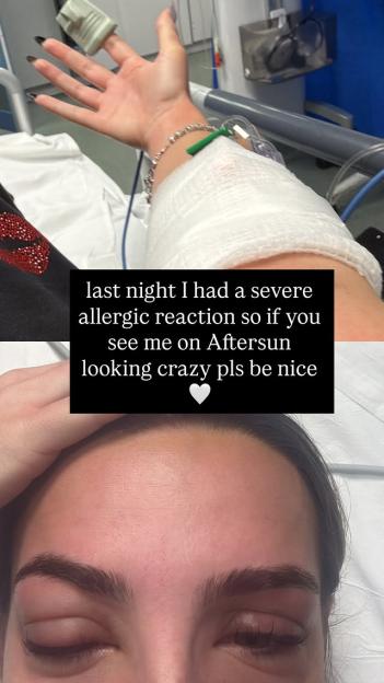Love Island's Toni Laites Opens Up About Frightening Hospital Visit Due to Severe Allergic Reaction
