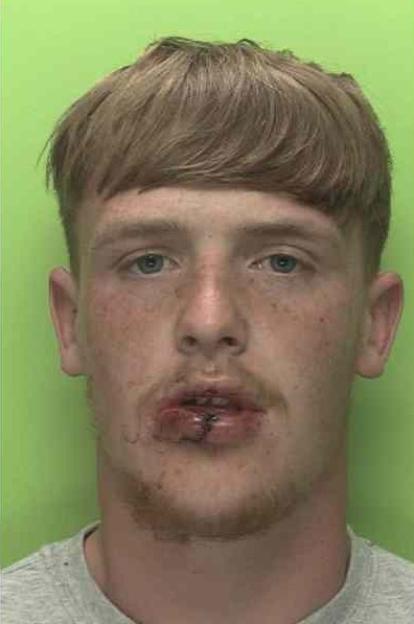 Mugshot of Brandon Byrne with a cut lip.