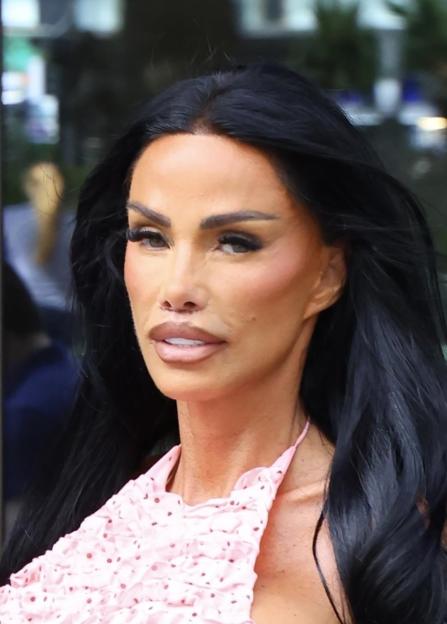 *PREMIUM-EXCLUSIVE* *MUST CALL FOR PRICING* Katie Price shows off the results of her lip lift surgery as she leaves a central London hotel