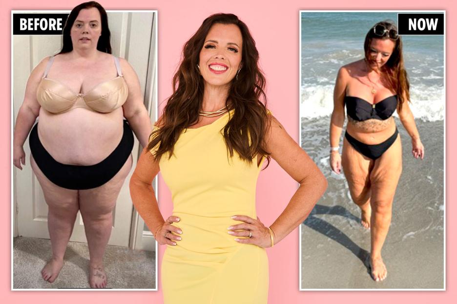 'At 24 Stone and a BMI of 56, I Had to Stay Awake During Surgery – It Changed My Life Forever!'