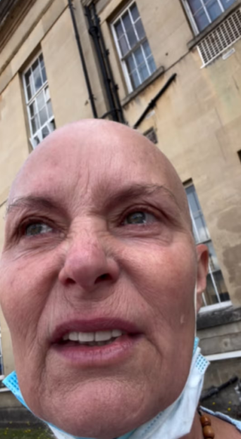 A bald person with a mask around their neck making a distressed face.