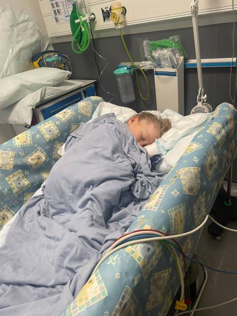 A young child sleeping in a hospital bed with visible injuries on their forehead.