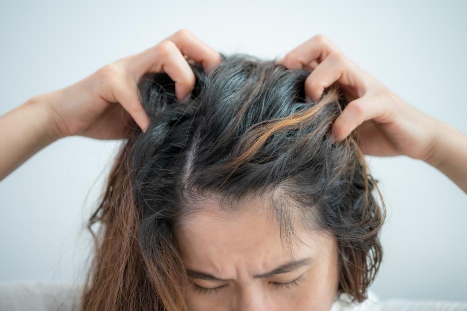 A woman scratching her itchy scalp.