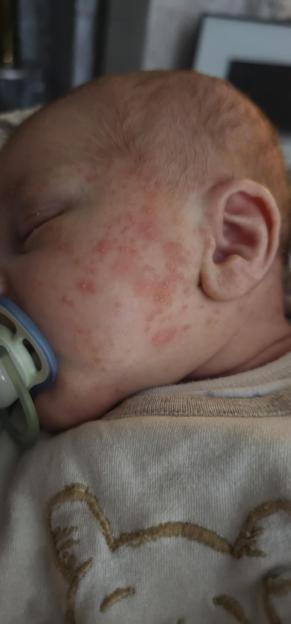 Mum shares warning after Fairy detergent left baby "ripping face off" in irritation