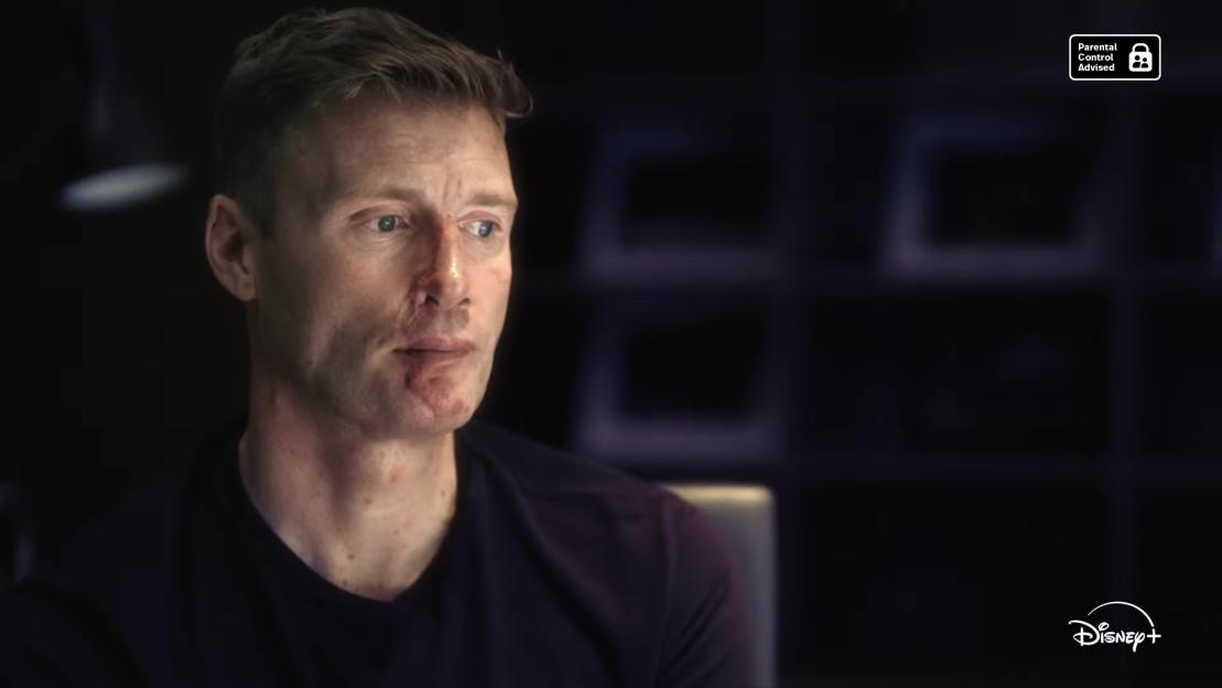 Andrew 'Freddie' Flintoff, with visible facial injuries, appears in the Disney+ documentary "Flintoff."