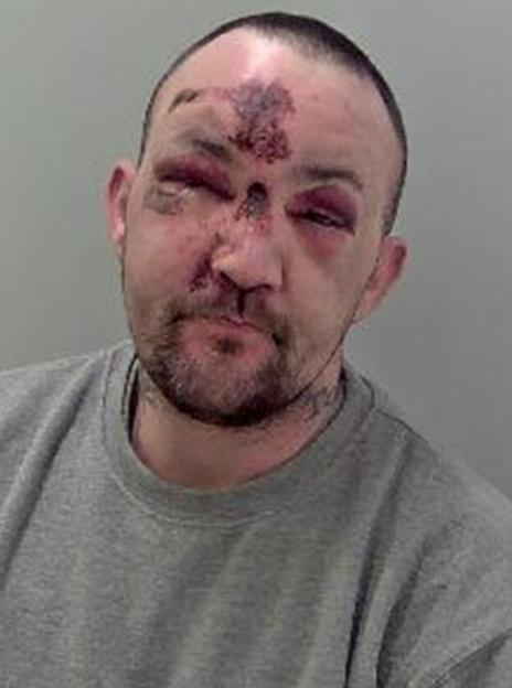 Mugshot of Matthew Jonathan, 39, with severe facial injuries.