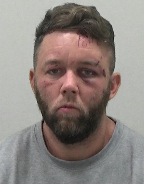 Mugshot of Ross Neville, a 35-year-old man, with visible injuries on his face and forehead.