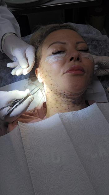 Im like Frankensteins bride after having FULL BODY makeover  even my eyelids and vagina have been transformed