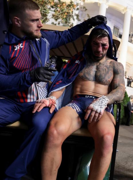 A UFC fighter with a bruised face and bloodied hands is helped by another man in front of the White House.