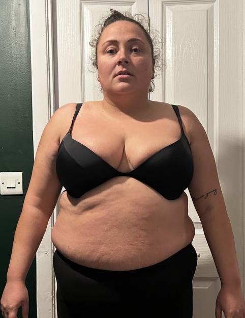 From Diets to Fat Jabs: Why I'm Now More Frustrated with My Appearance Than Ever