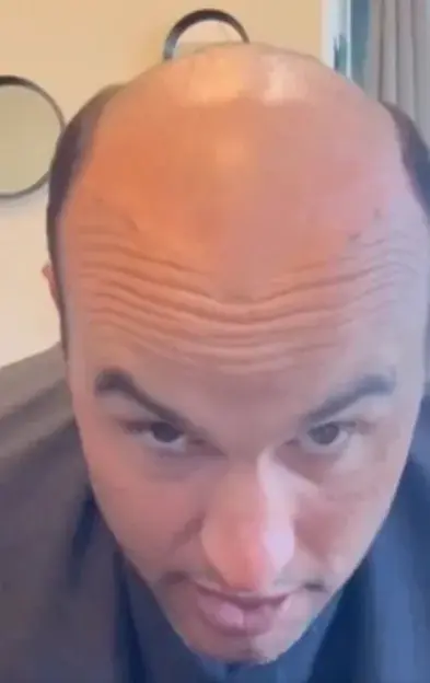 A man with a receding hairline and wrinkled forehead looks intently at the camera from above.