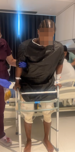 Patient supported by a nurse while walking with a frame, wearing leg bandages and a urine collection bag.