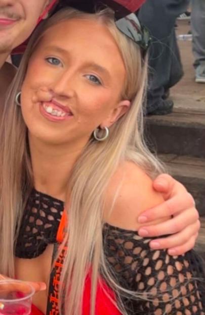 A dog Id known for years ripped my face apart in seconds  I just want to look normal again