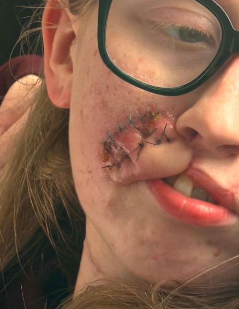 A dog Id known for years ripped my face apart in seconds  I just want to look normal again